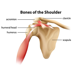 Conventional Vs Reverse Total Shoulder Replacement Direct Orthopedic Care