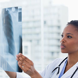 Female doctor looking at an x-ray image.