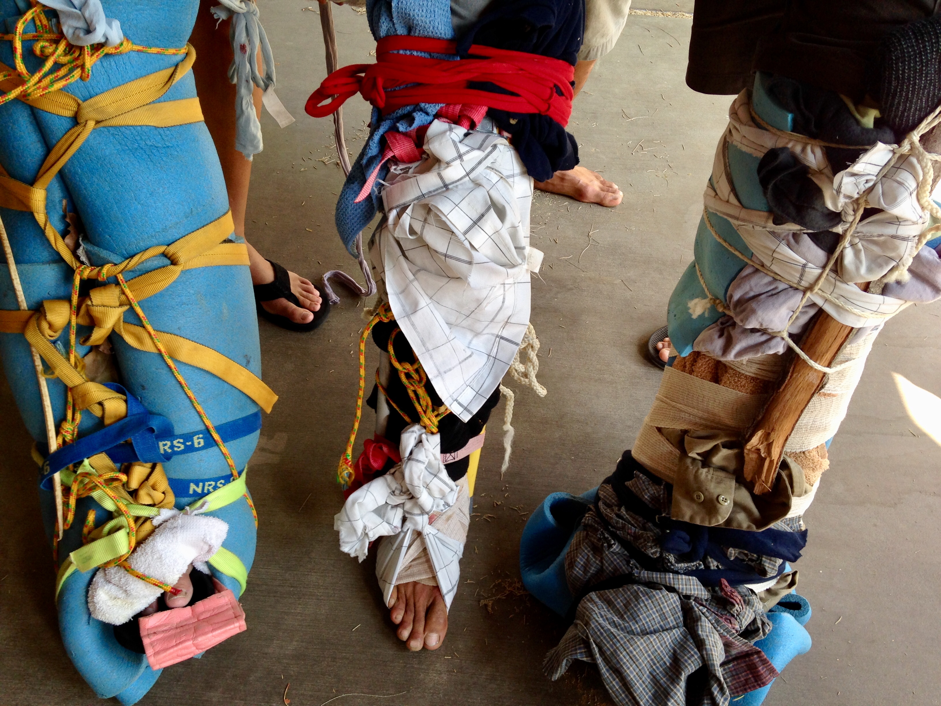 Multiple people with wilderness splints on their legs.