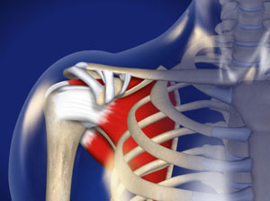 Internal view of shoulder demonstrating pain area