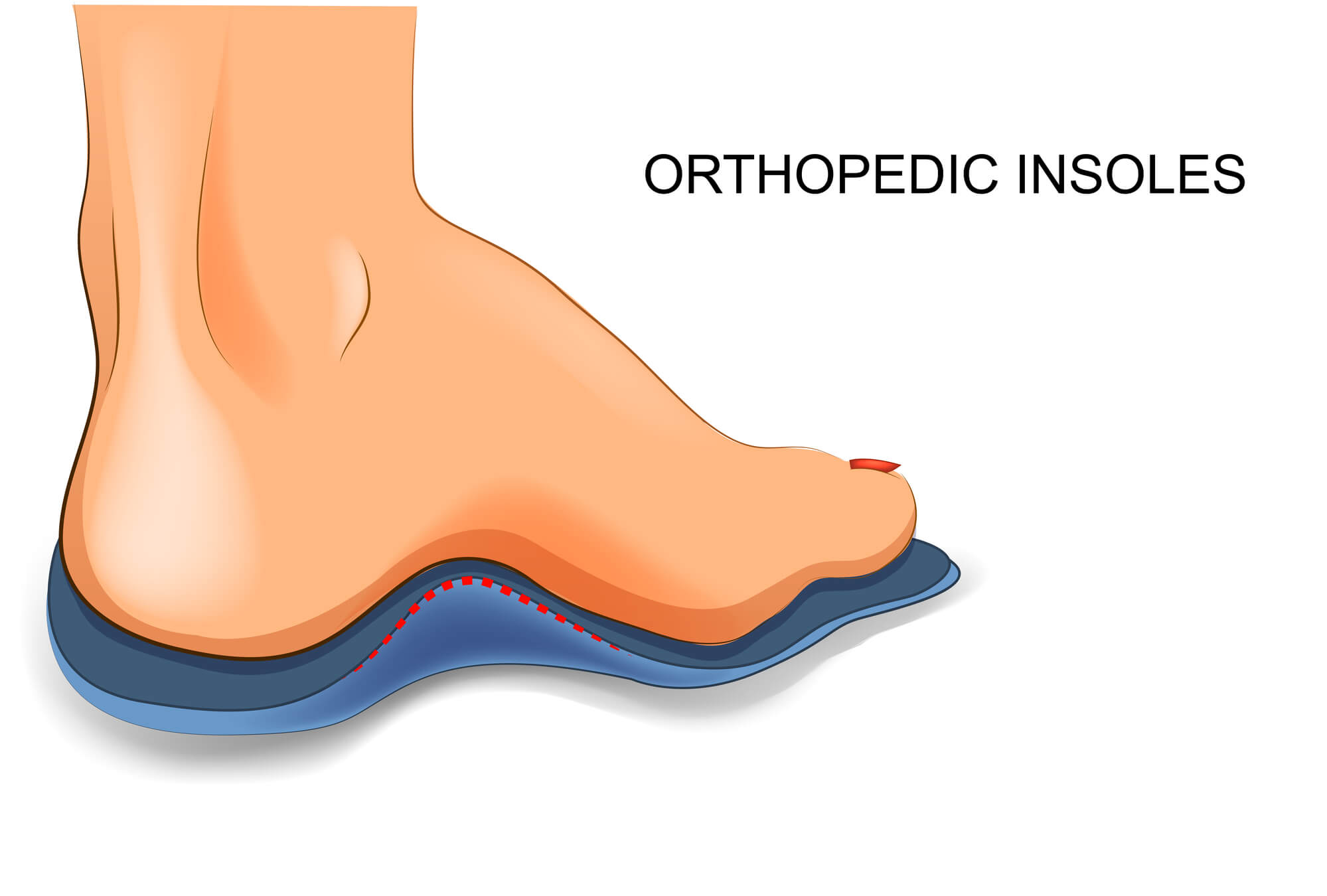 Illustration of human foot, with text reading "Orthopedic Insoles".