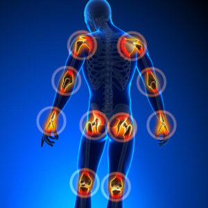 Illustration of body that highlights major joints.