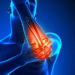 Illustration of upper body that highlights the elbow.