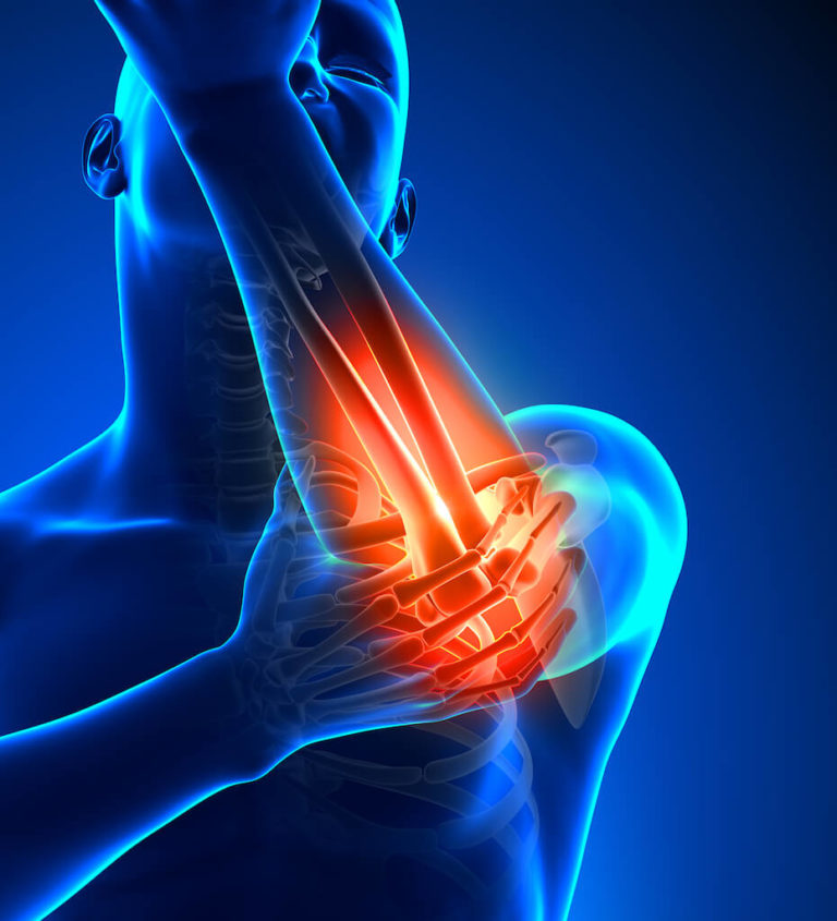 Arm and Elbow Condition Groups Direct Orthopedic Care