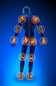 Illustration of body that highlights major joints.