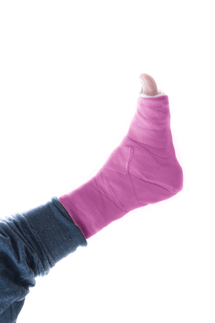 Foot in a pink cast.