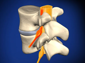 Illustration of Lumbar