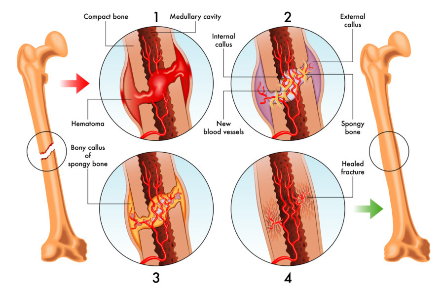 Foot Condition Groups Direct Orthopedic Care